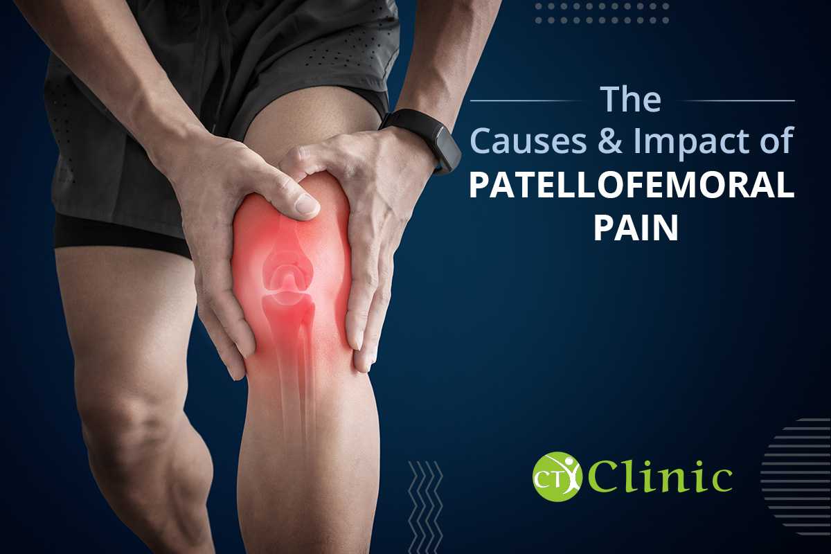 The causes and impact of Patellofemoral Pain