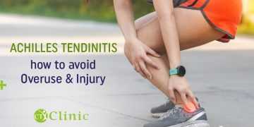 Achilles Tendinitis: how to avoid overuse and injury.