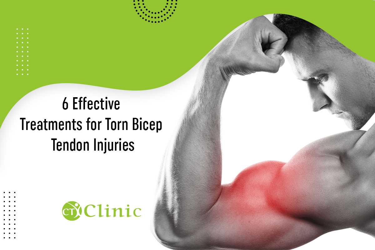 6 Powerful treatments to treat your torn bicep tendon injury