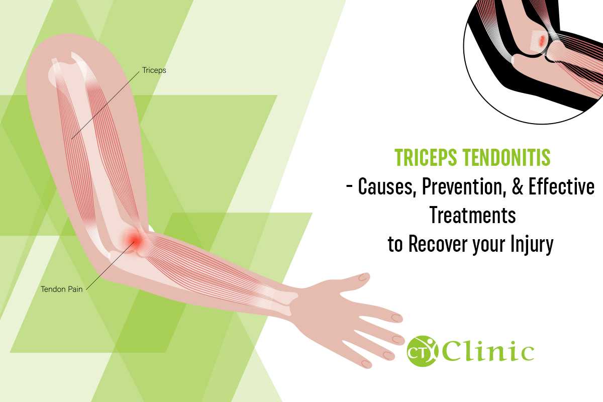 Effective Treatments to Recover Tricep Injuries
