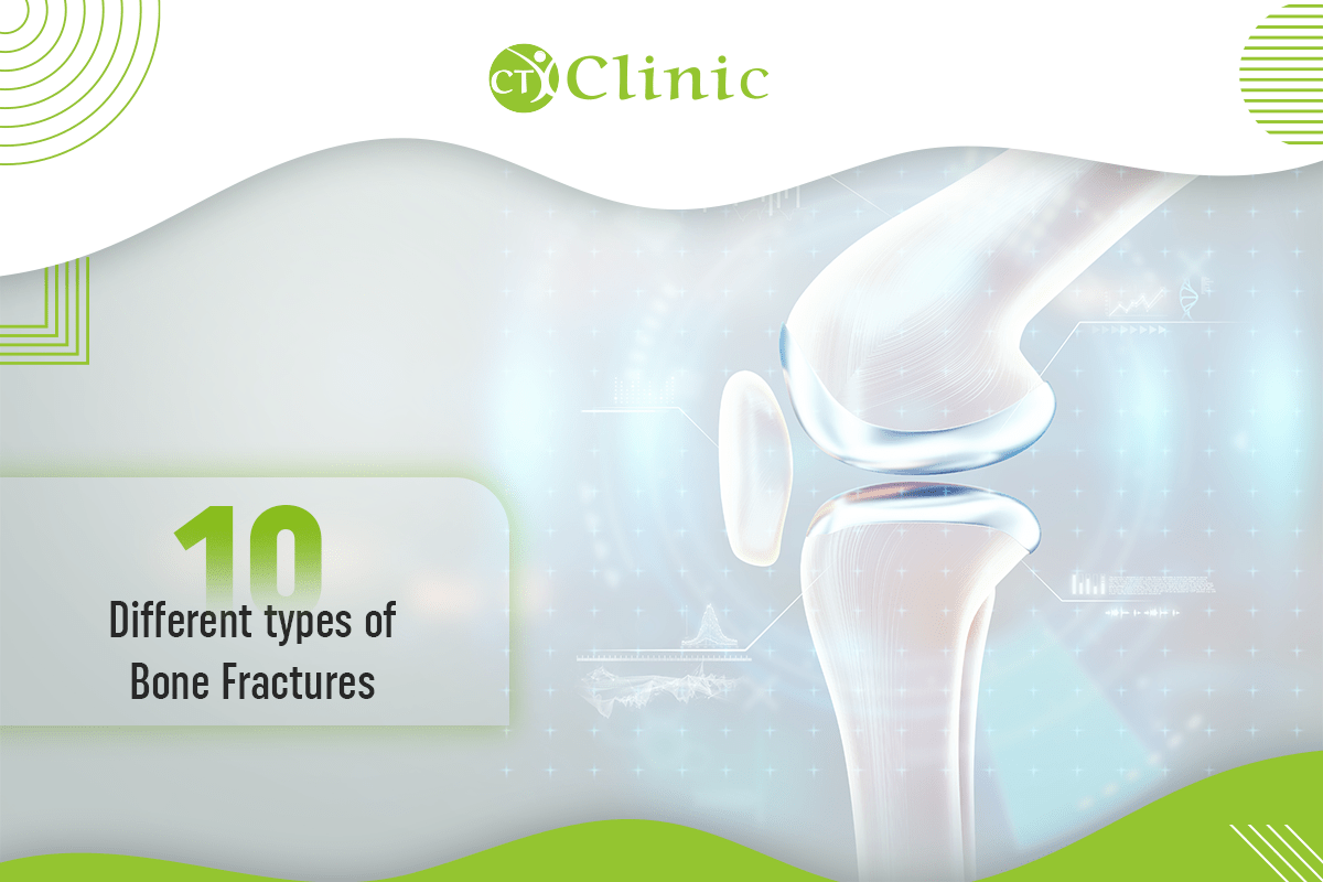 Different types of Bone Fractures